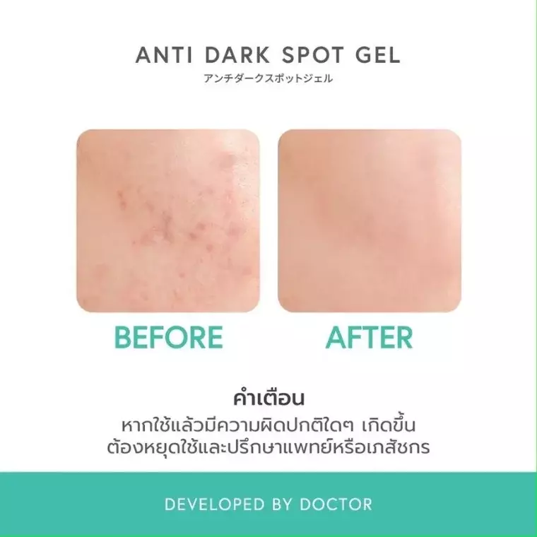 Acca By Dr.DSP Anti Dark Spot Gel (15gm)
