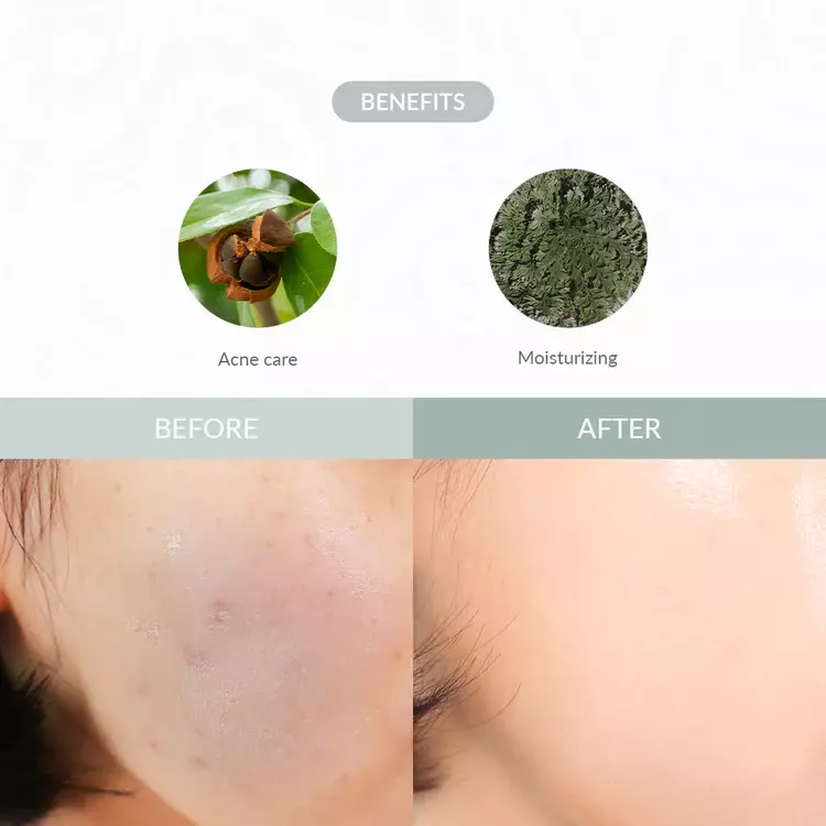 Dr. Althea Last Minute Skin Rescue Anastatica Mask (531g)