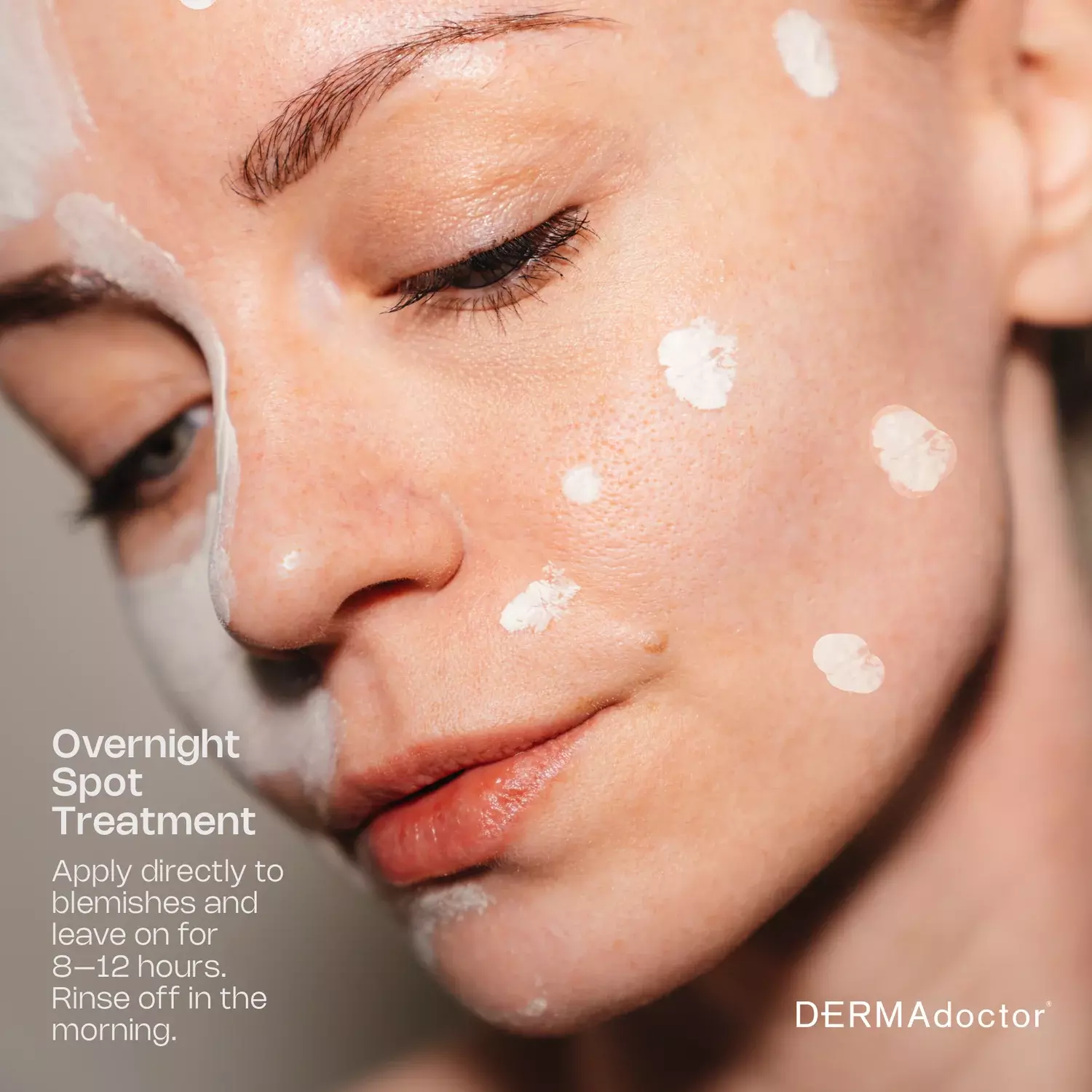 DERMADOCTOR Ain't Misbehavin intensive 10% Sulfur Acne Mask