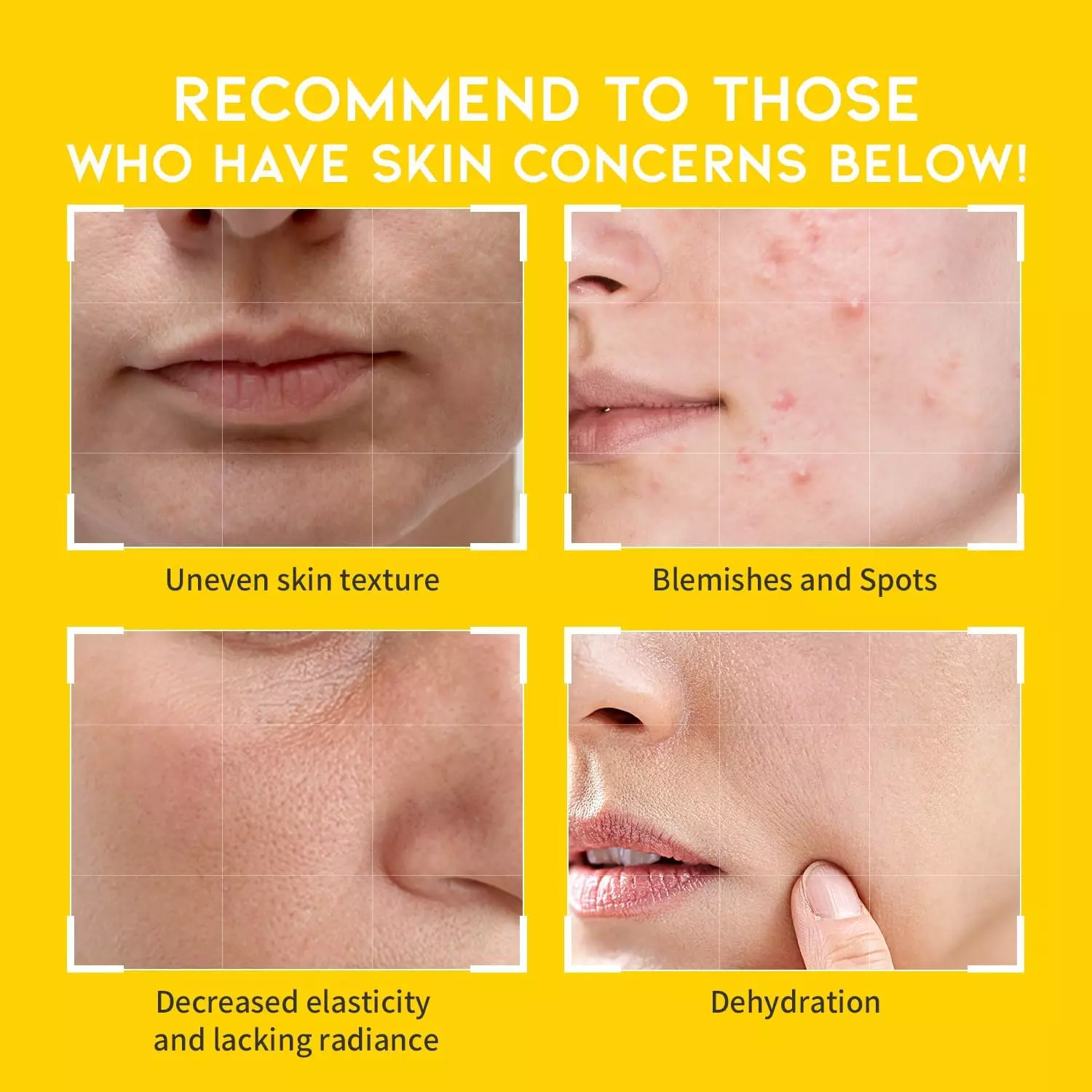 OOTD Vitamin C Dark Spot Toner Pad (120ml)