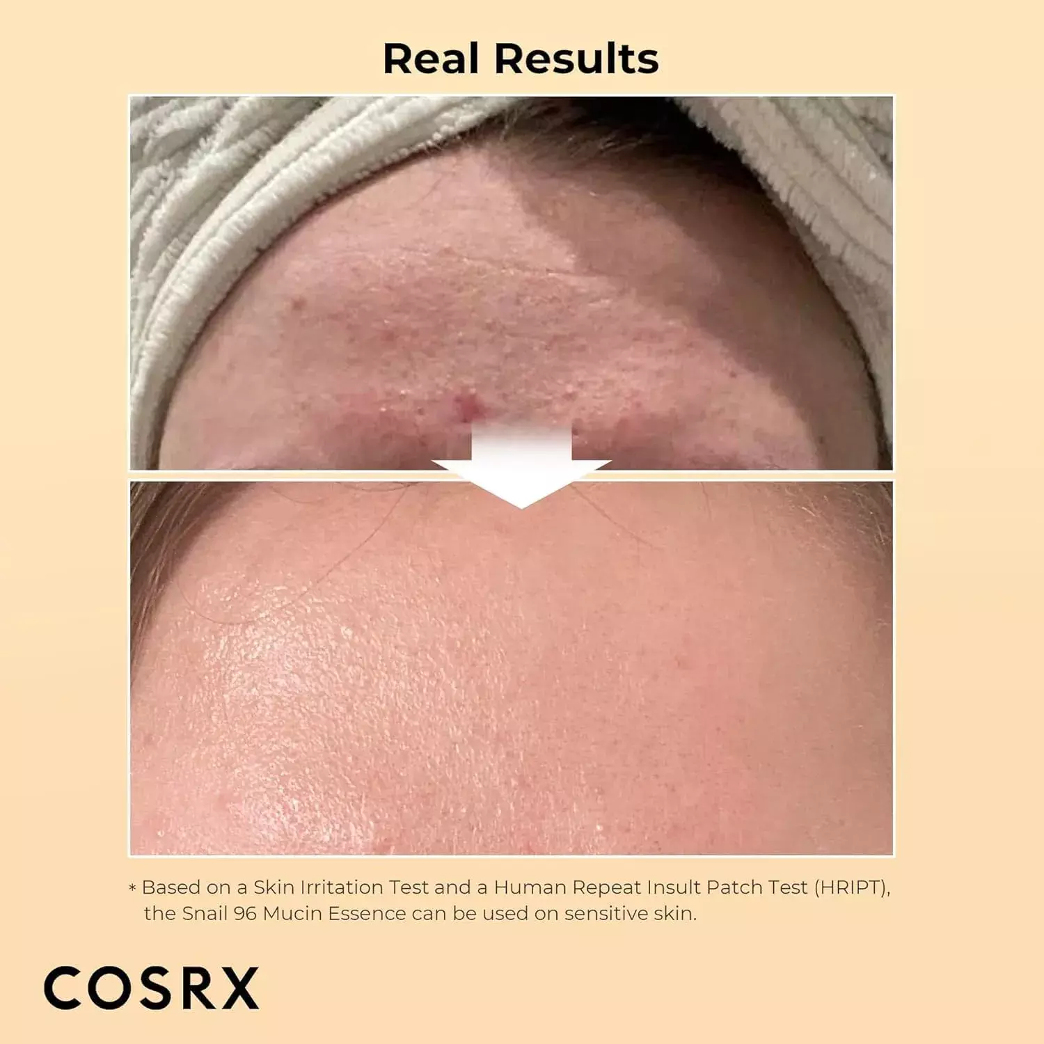 Cosrx Advanced Snail 96 Mucin Power Essence (30ml)