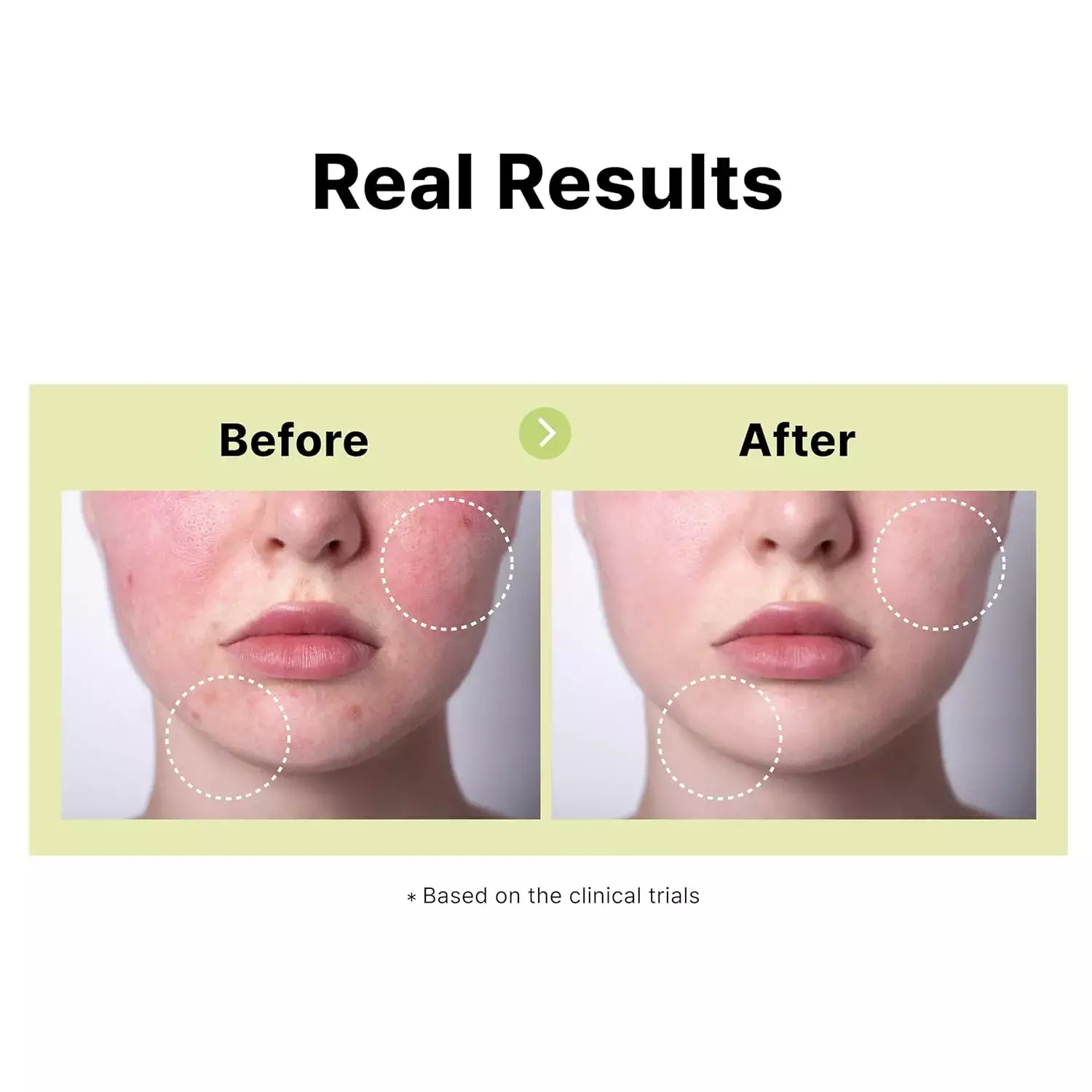 Dear My Dew Azelaic Acid 10% Serum