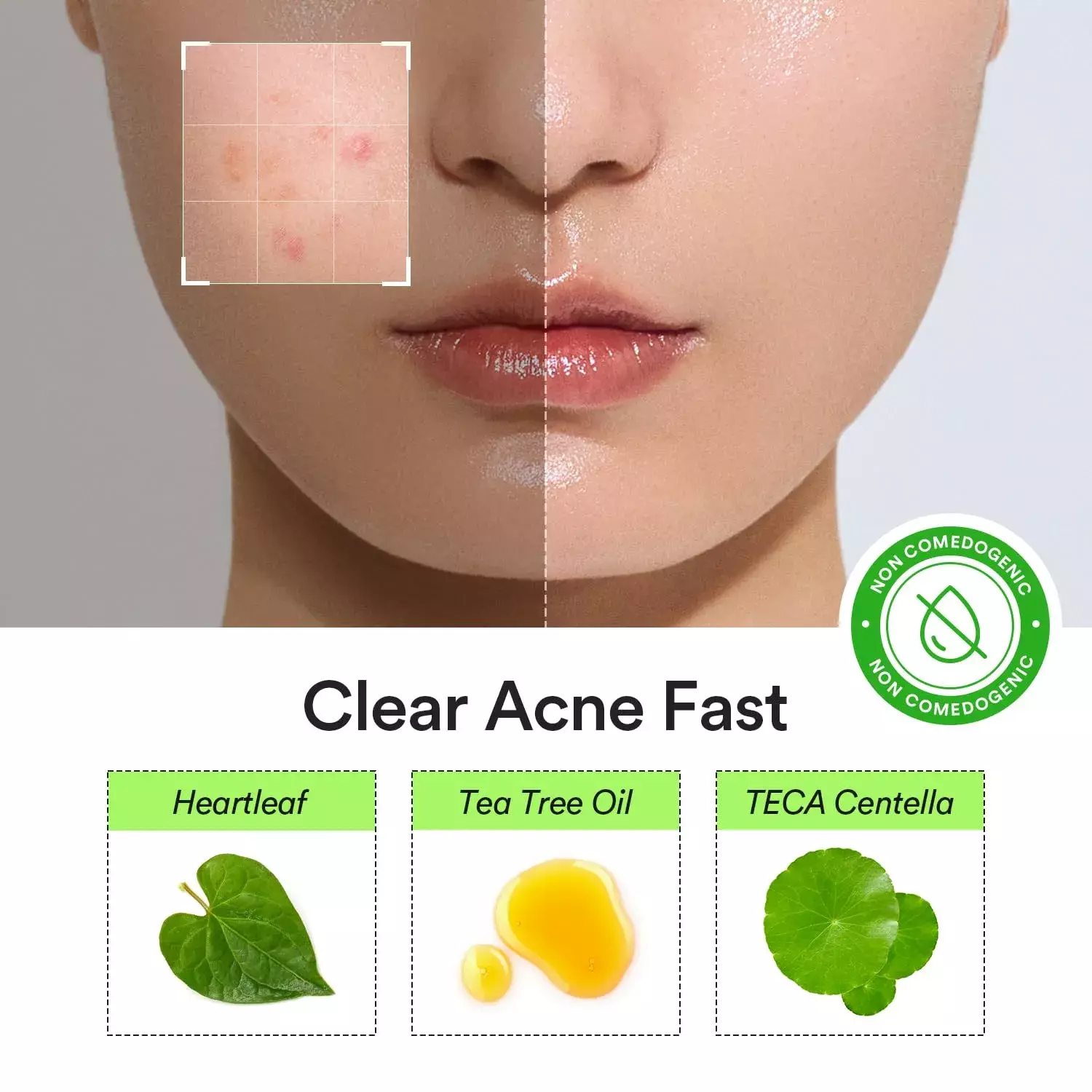 Abib Heartleaf Calming Spot Patch (78 patches)