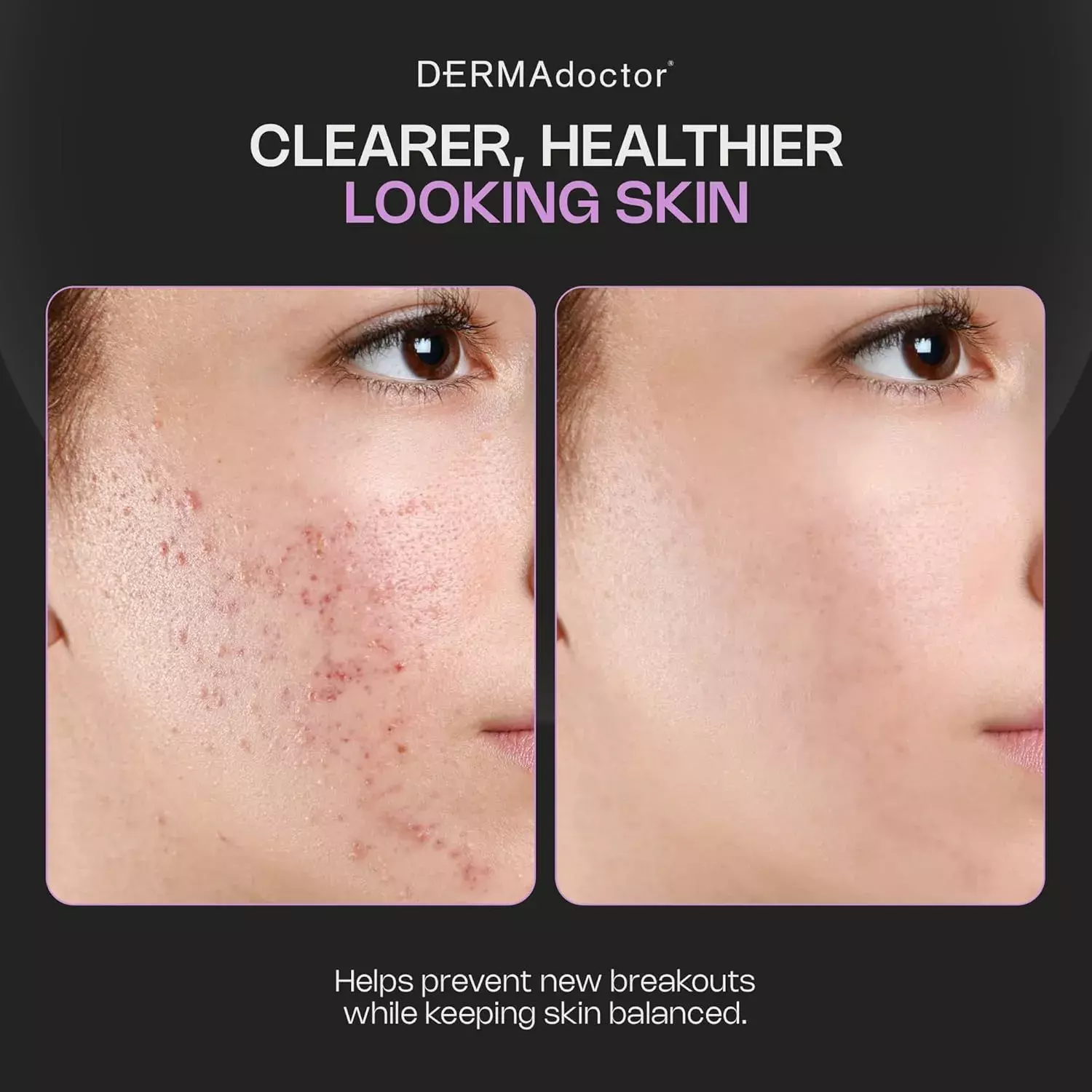DERMADOCTOR Ain't Misbehavin intensive 10% Sulfur Acne Mask