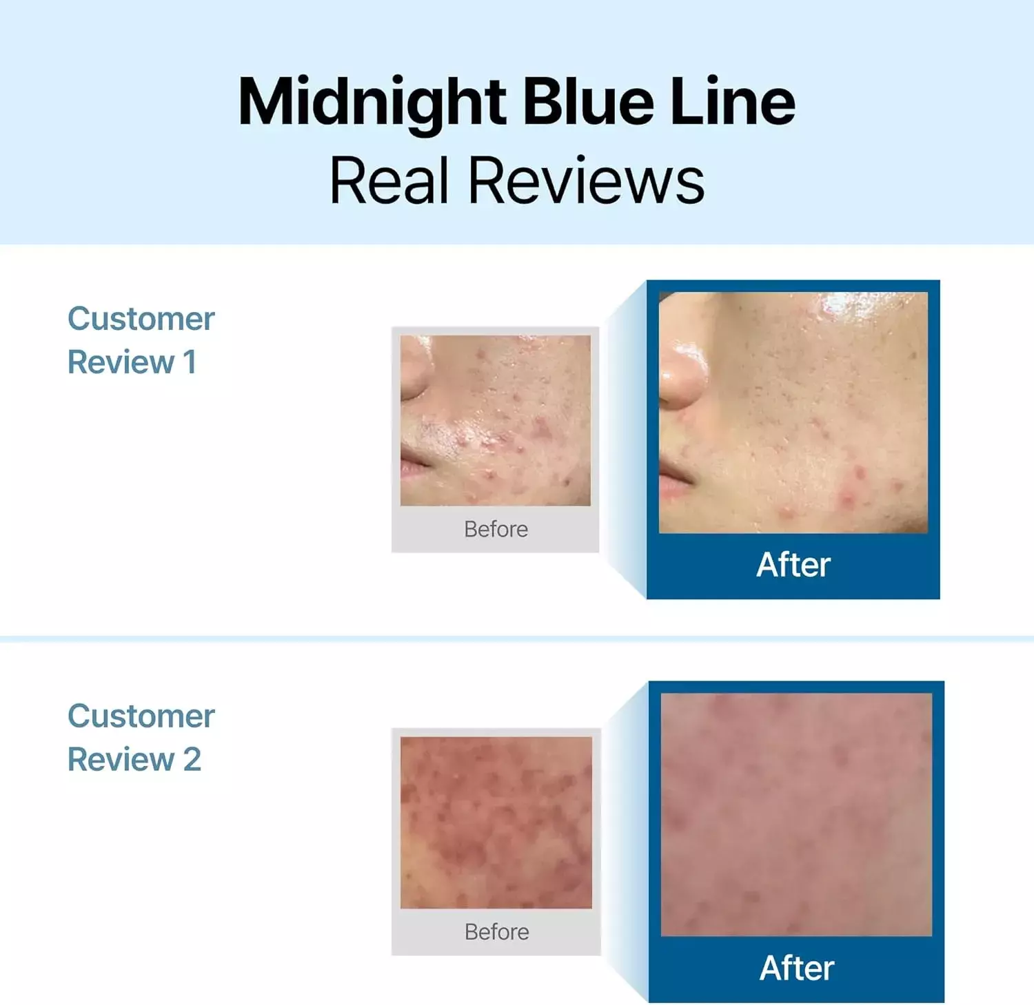 Dear Klairs Midnight Blue Calming Cream (60ml)
