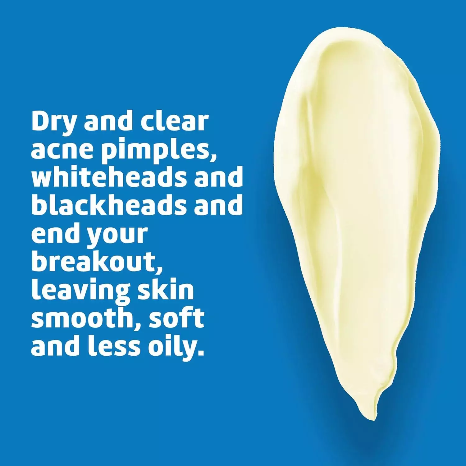 De La Cruz Acne Treatment for Sensitive Skin with 5% Sulfur