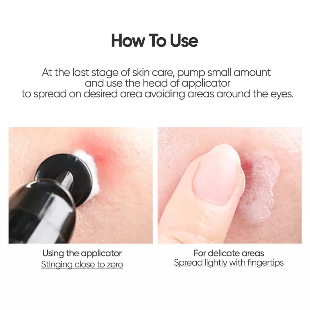 Commonlabs Vitamin E Micro Needle Spot Cream (10ml)