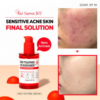 Some By Mi Red Teatree Cicassoside Final Solution Serum