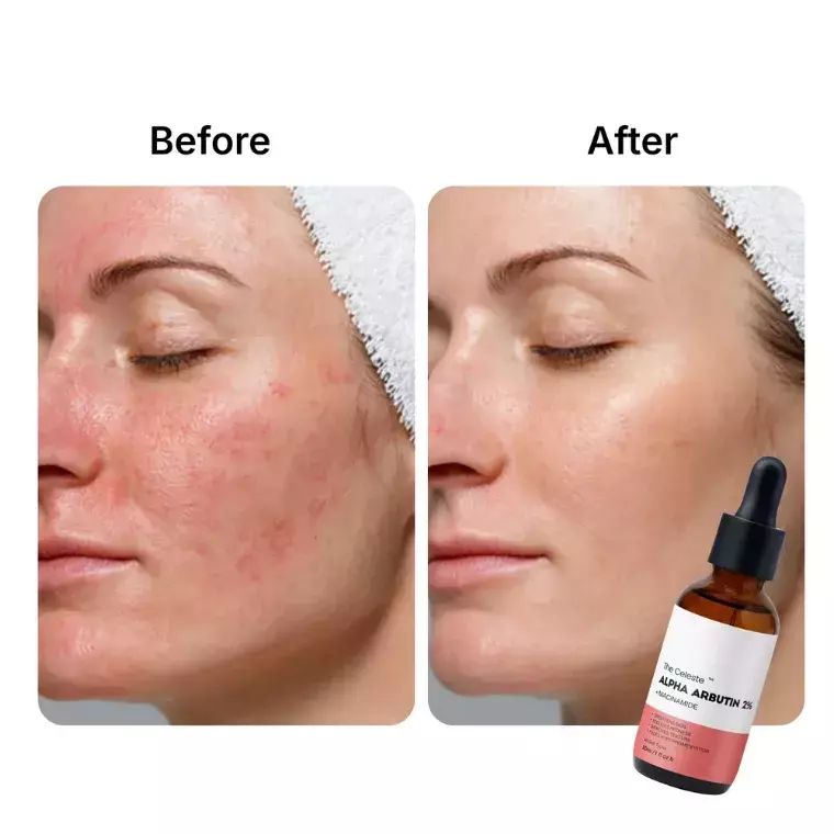 The Celeste Alpha Arbutin 2% + Niacinamide (30ml)