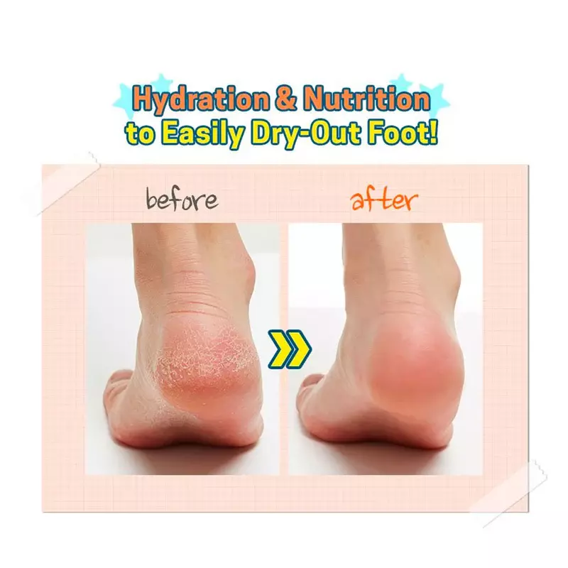 Apieu Soft Foot 30 Minute Peeling Socks