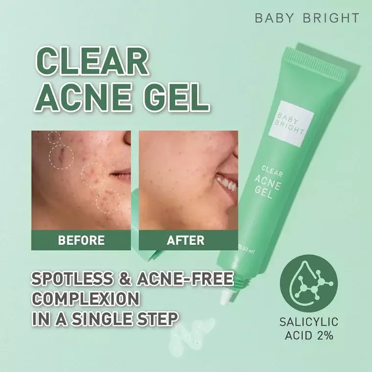 Baby Bright Clear Acne Gel (15gm)