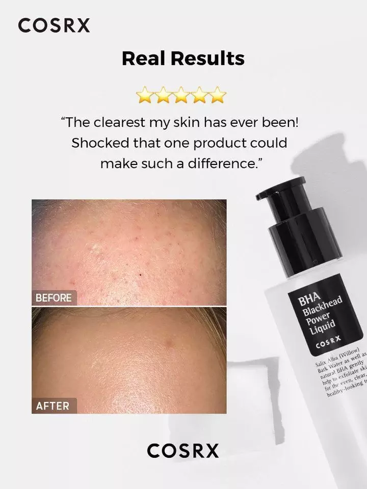 Cosrx BHA Blackhead Power Liquid (100ml)