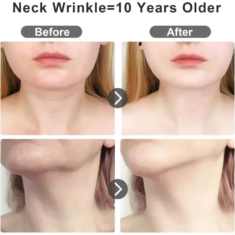 Blink Intense Pulsed Light Wrinkles Reducing Instrument ES-1081 #White