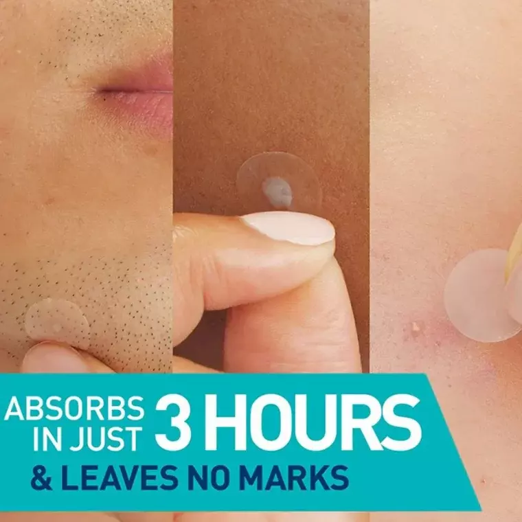 CeraVe Blemish Barrier Patch (22pcs)