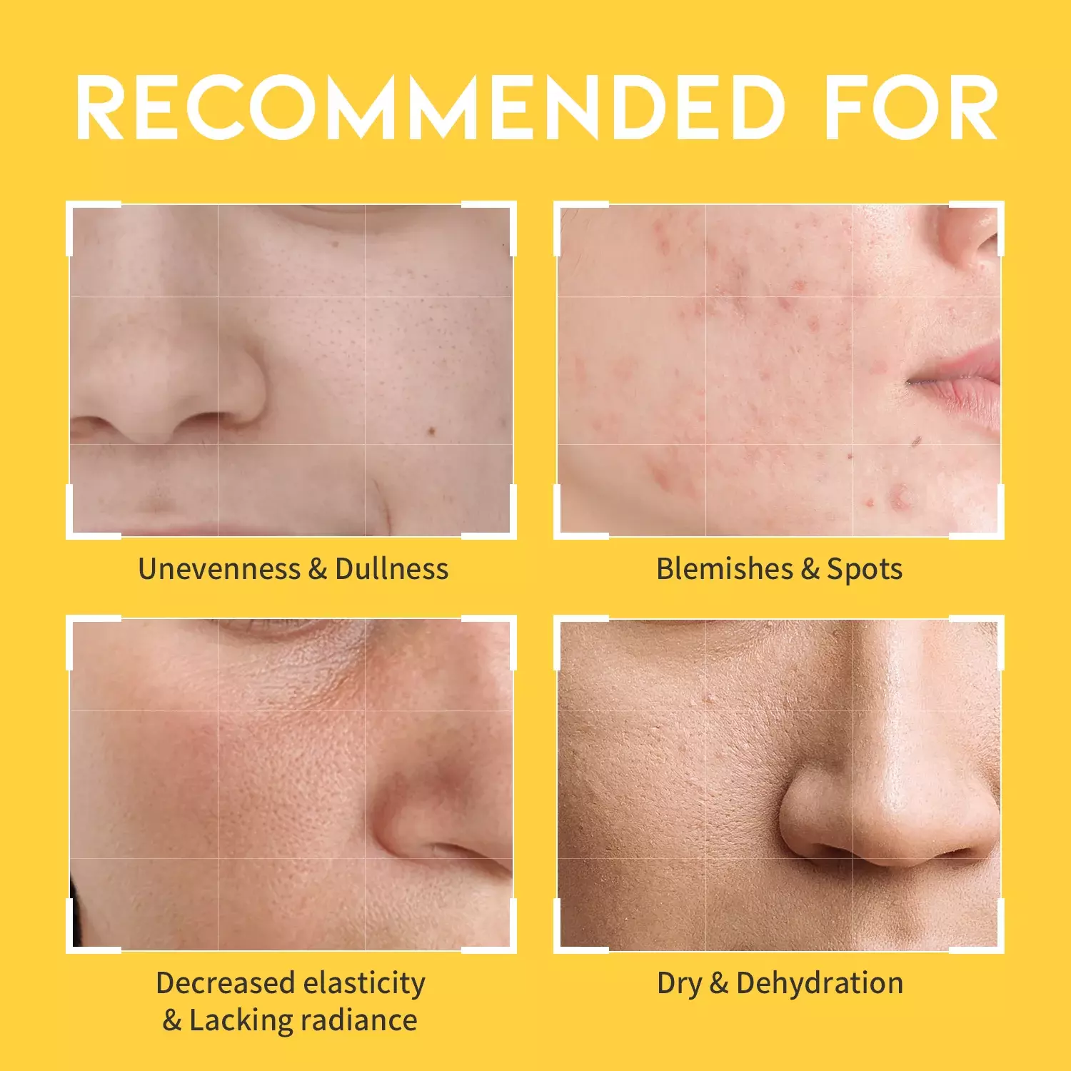 OOTD Dark Spot Vitamin C Toner (250ml)