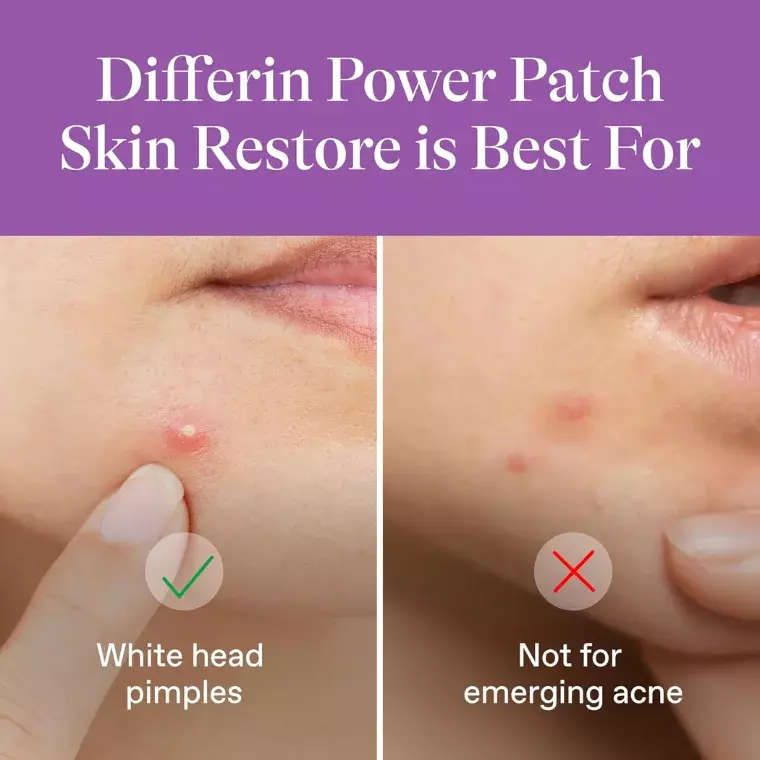 Differin Power Patch Skin Restore (23patches)