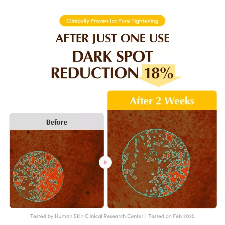 Eqqualberry Collagen Glow Up Hydrogel Mask (22gm)