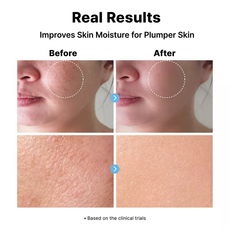 Dear My Dew Hyaluronic Acid 2% Serum