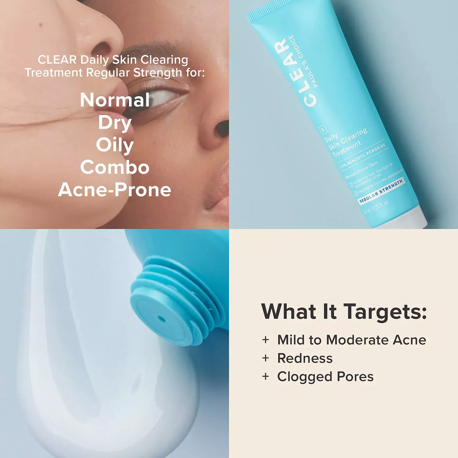 Paulas Choice Clear Regular Strength Daily Skin Clearing Treatment with 2.5% Benzoyl Peroxide