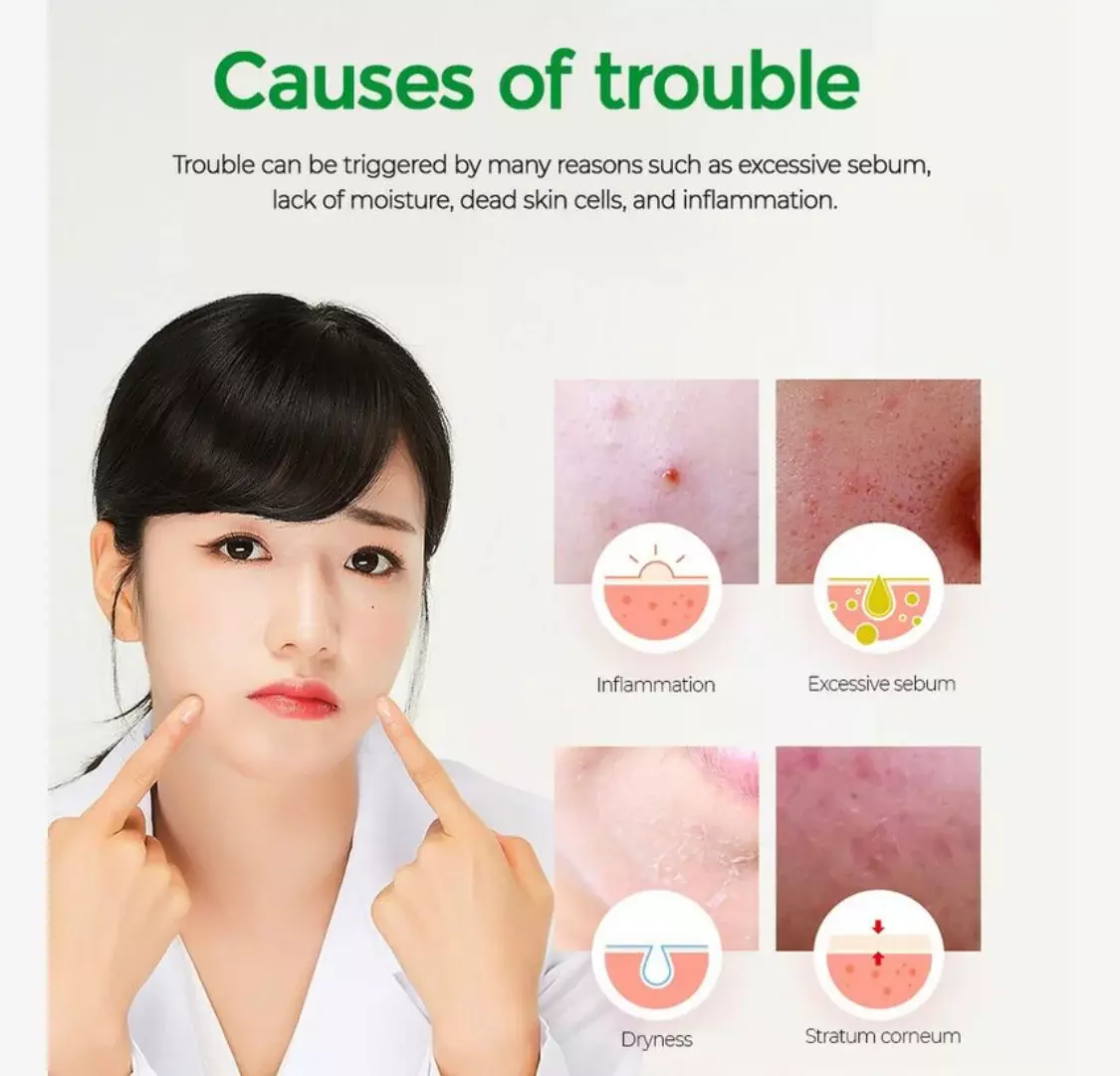 Acropass Trouble Cure
