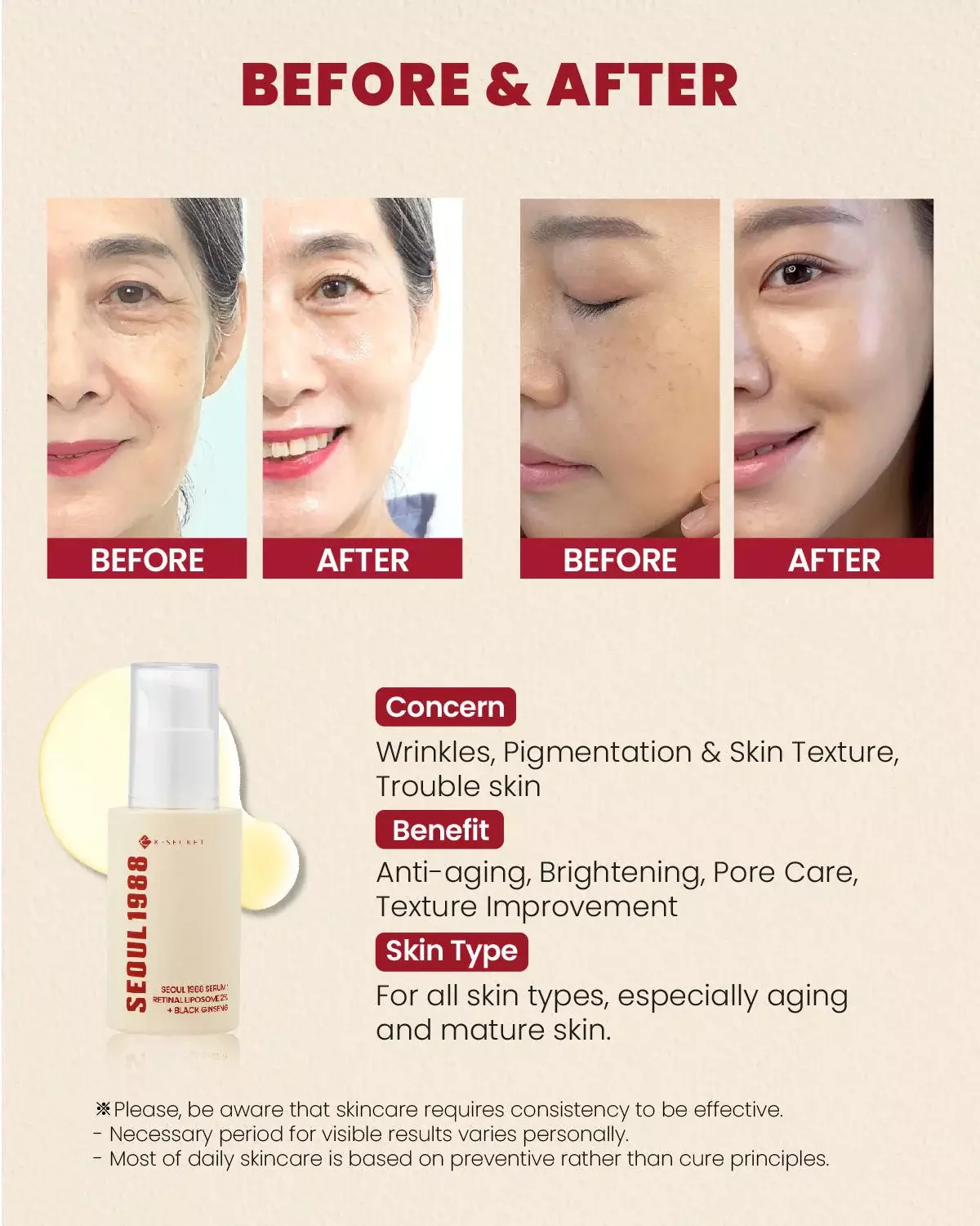 K-Secret Seoul 1988 Cream Retinal Liposome 1% + Fermented Rice 50ml