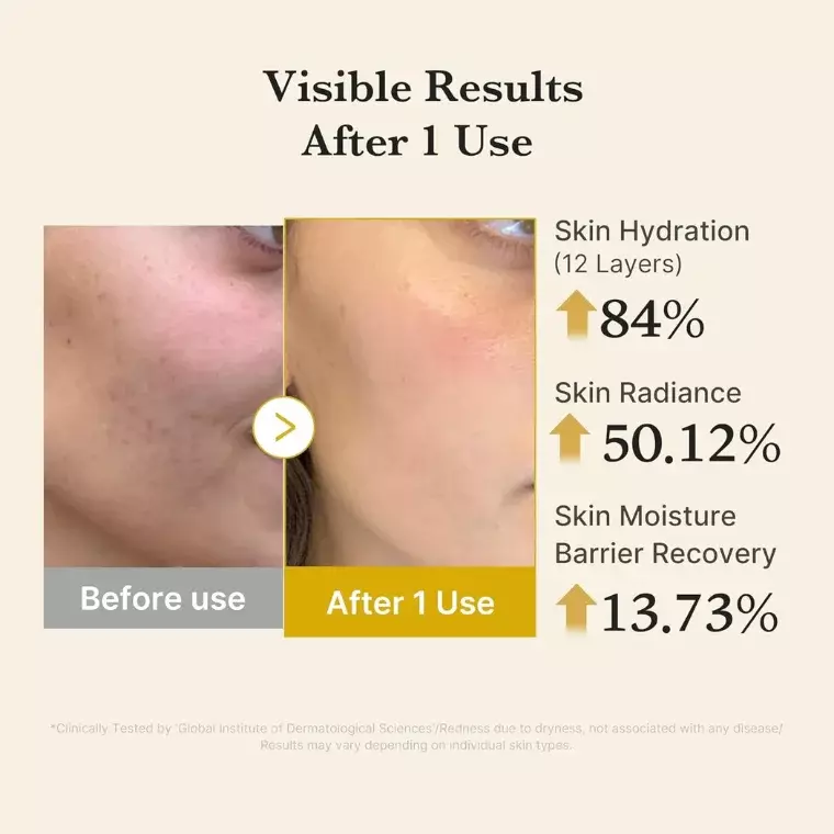 Medicube Kojic Acid Turmeric Vita Jelly Mist Serum (100ml)