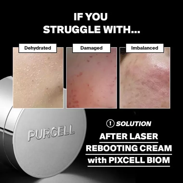 Purcel Bloom After laser Reboting Cream (50ml)