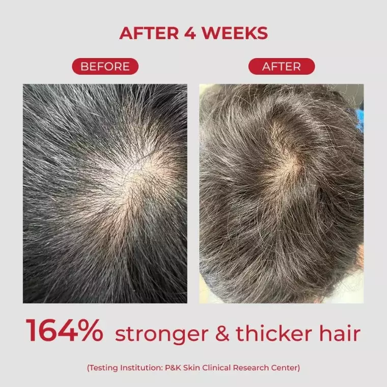 Moev Annurcatin Shampoo (300ml)