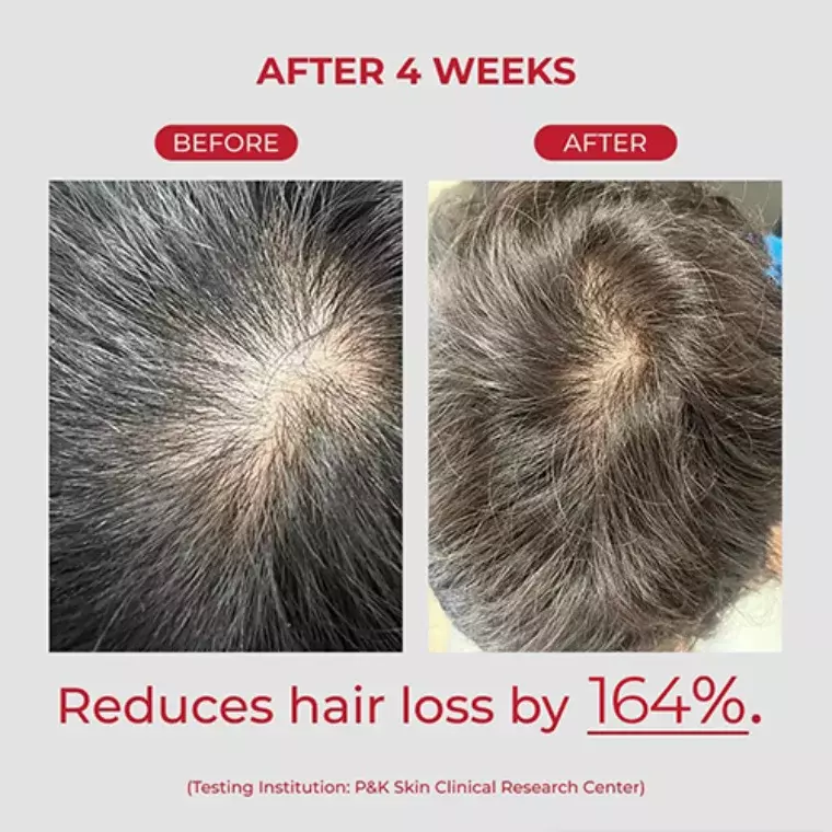 Moev Annurcatin Shampoo (525ml)