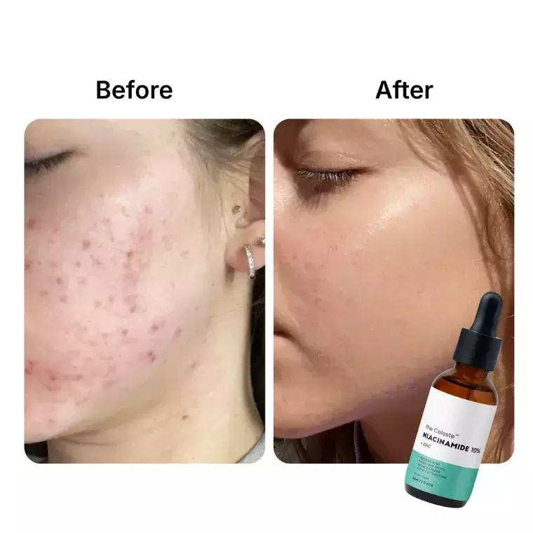 The Celeste Niacinamide 10% + Zinc (30ml)