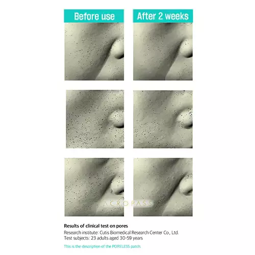Acropass Poreless Patch
