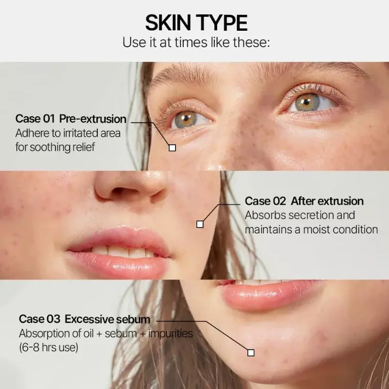 Parnell Cicamanu Clear Patch Multi+ (48ea)