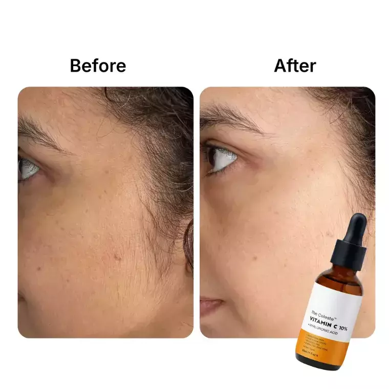 The Celeste Vitamin C 10% + Hyaluronic Acid (30ml)
