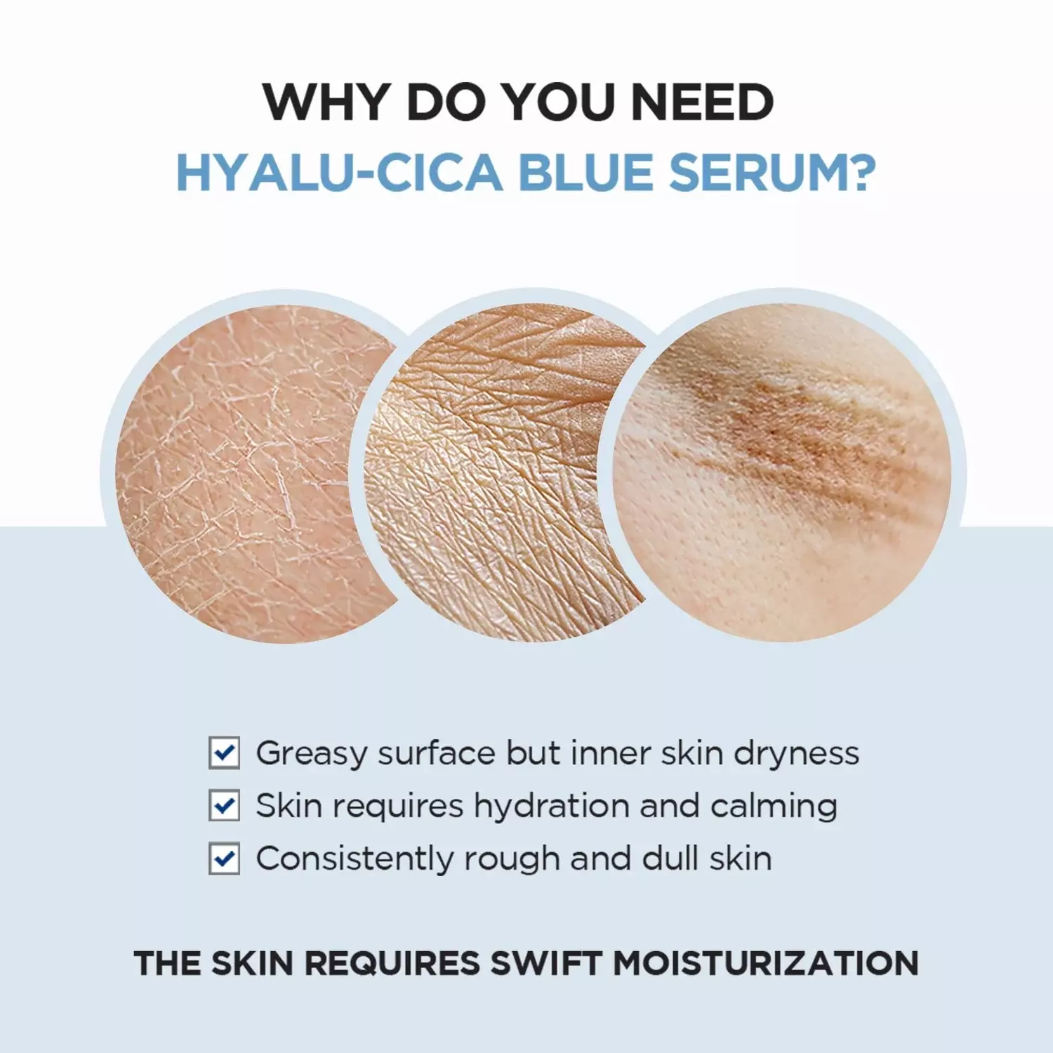 Skin1004 Hyalu-Cica Blue Serum (1.5ml)