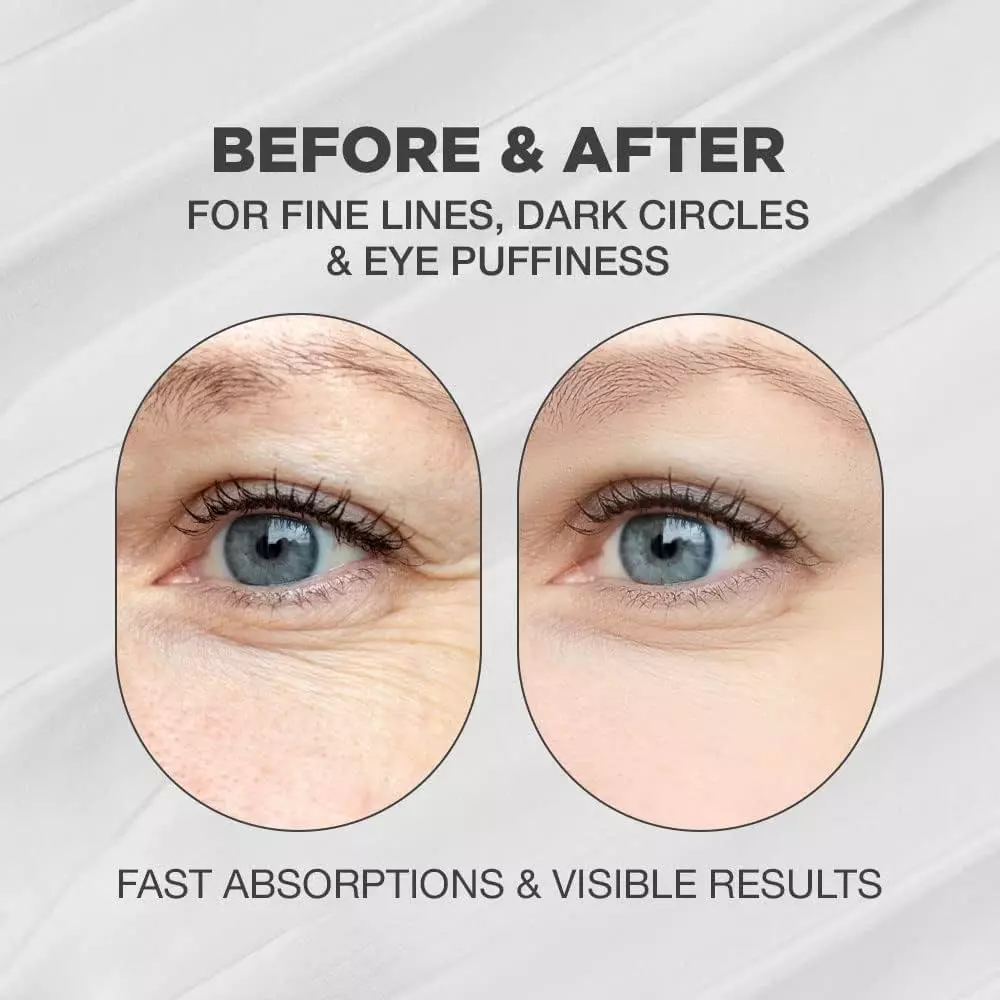 3W Clinic Snail Eye Cream (40ml)