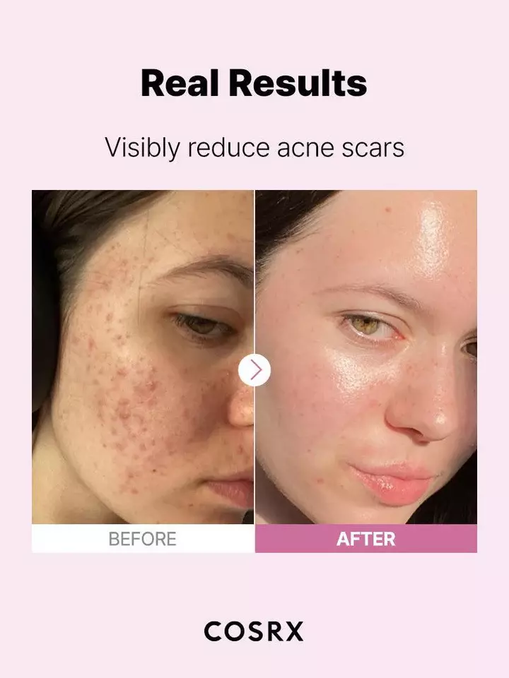 Cosrx The Niacinamide 15 Serum (20ml)