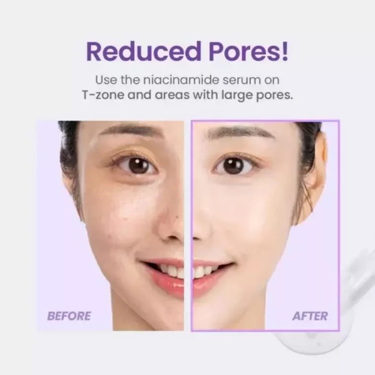 Tirtir Niacinamide 20% Serum (30ml)