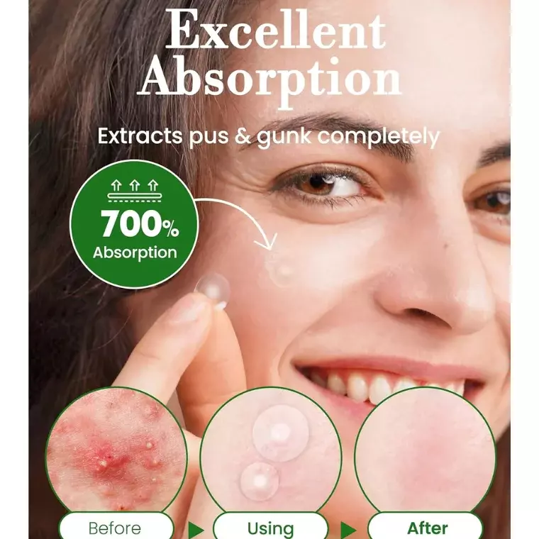 Troubless Invisible Pimple Patch Signature (96 Patches)