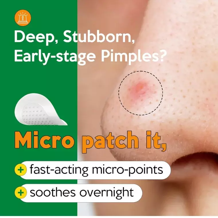 Troubless Micro Point Patch Limited Value Pack (4gm)