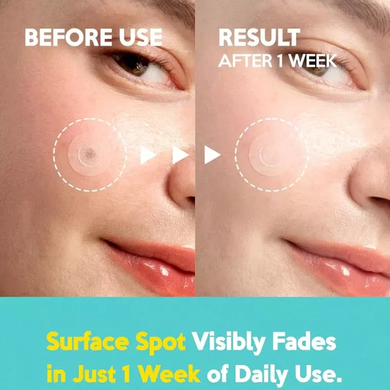 Troubless MicroPoint Pimple Patch 9 Patches (4gm)