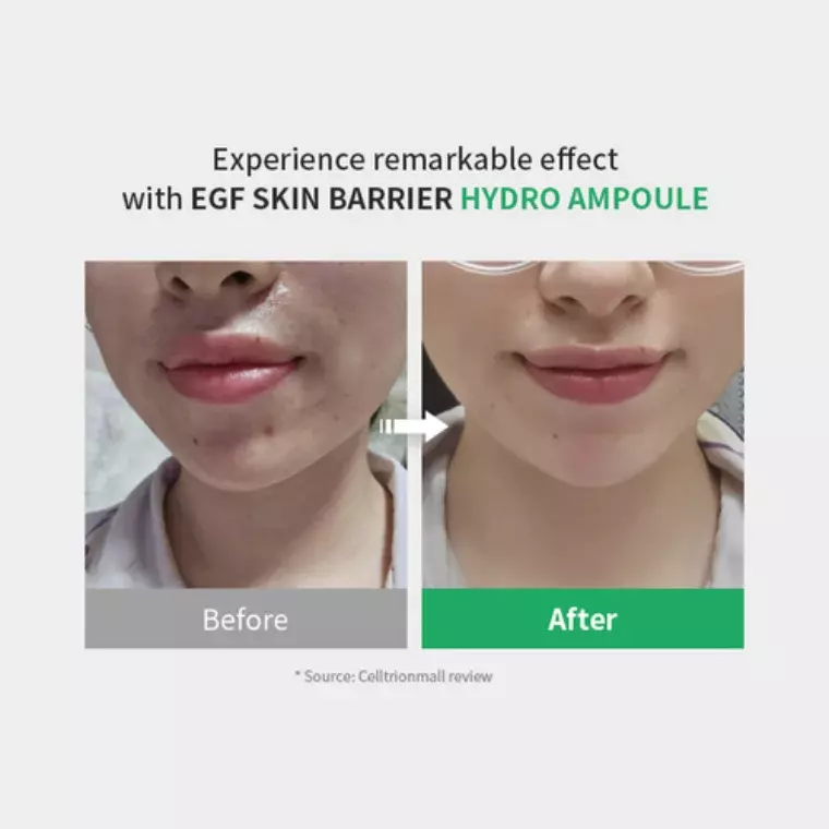 Zpiderm Egf Skin Barrier Hydro Ampoule (30ml)